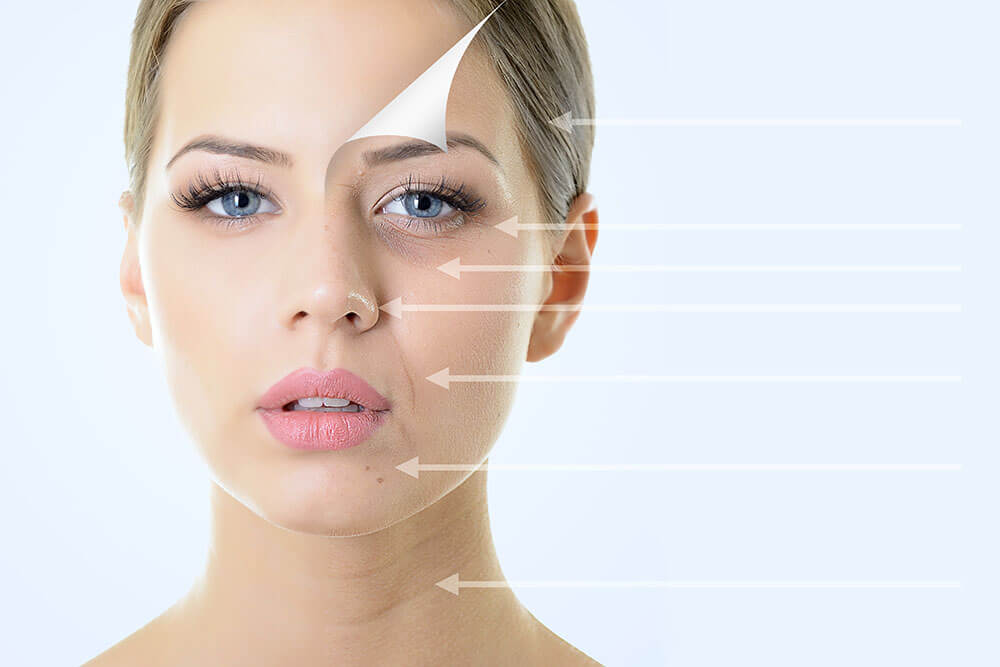 Best botox treatment in Lahore