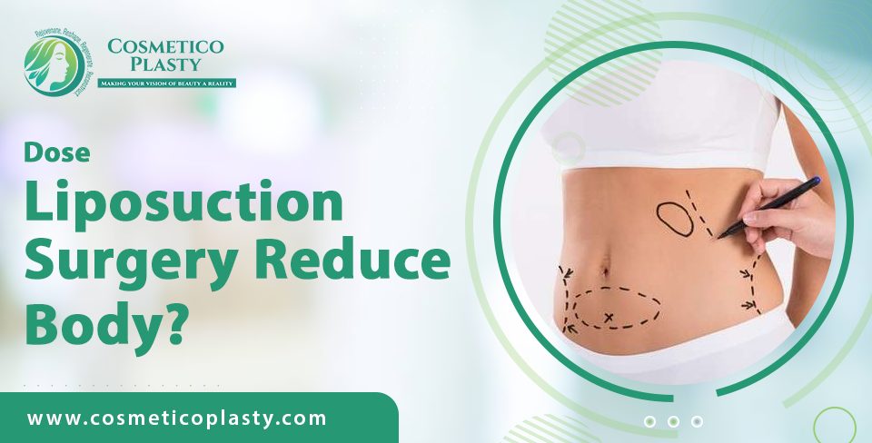 liposuction surgery reduce body