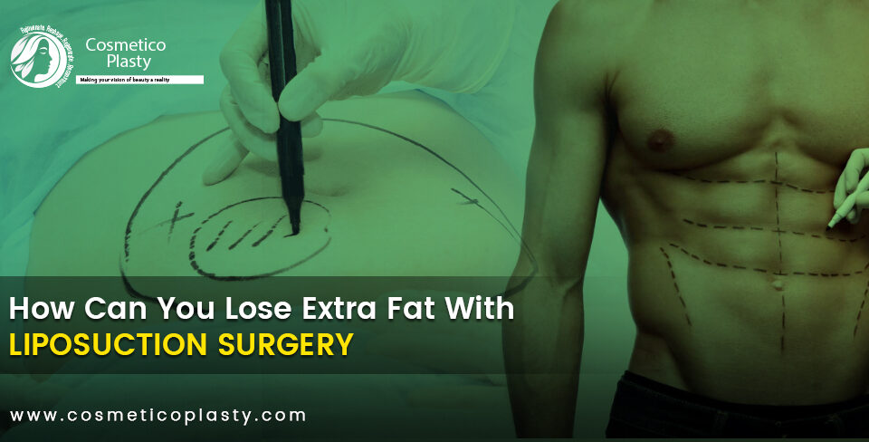 lose extra fat with liposuction.