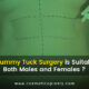 tummy tuck surgery is suitable