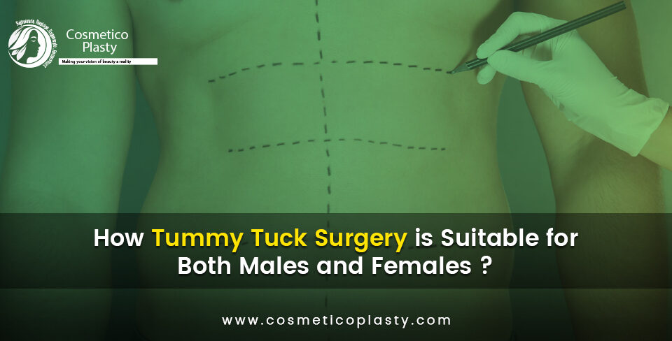 tummy tuck surgery is suitable