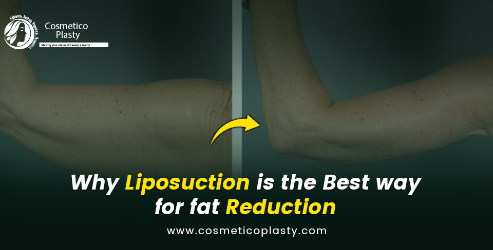 best way for fat reduction