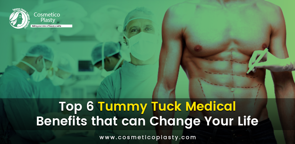 tummy tuck medical benefits