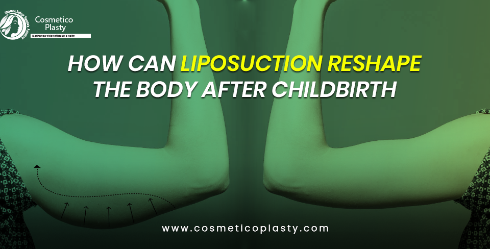 How can liposuction reshape the body after childbirth