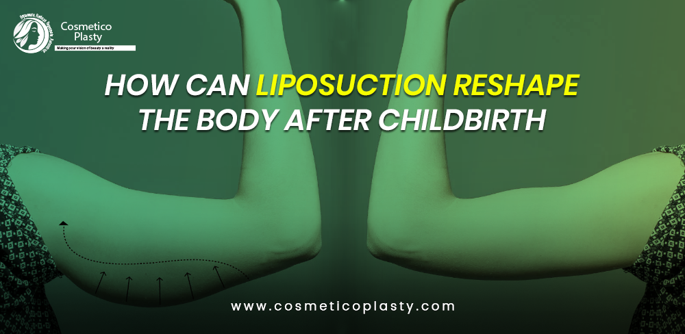 How can liposuction reshape the body after childbirth