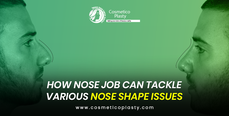 How nose job can tackle various nose shape issues?