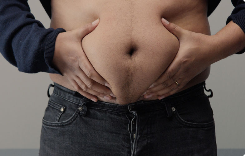 tummy tuck cost in lahore