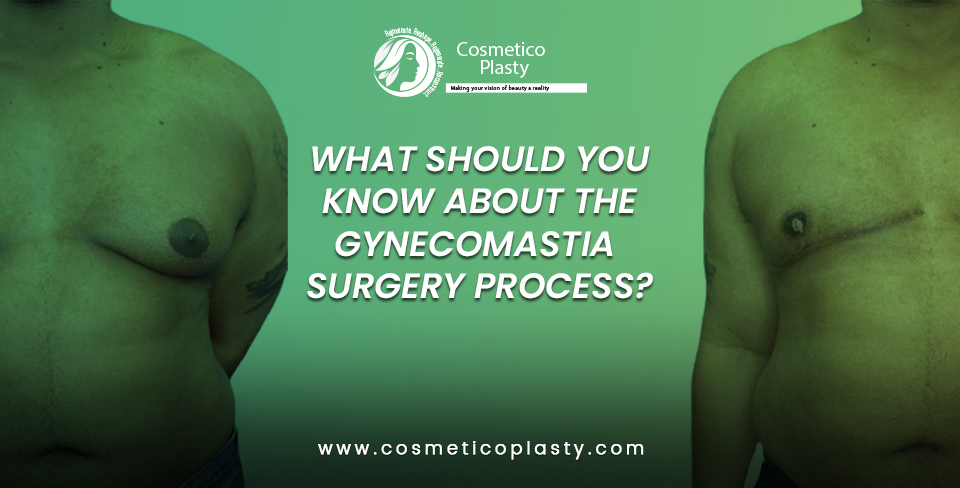 Gynecomastia surgery process