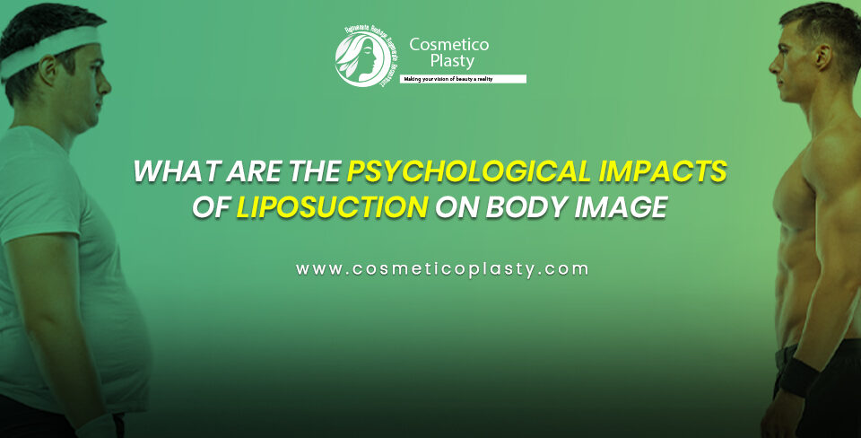 Psychological impacts of liposuction