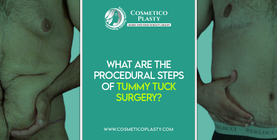 Steps of tummy tuck surgery