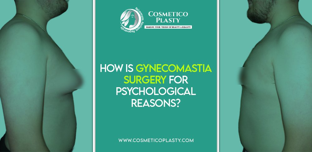 Gynecomastia Surgery