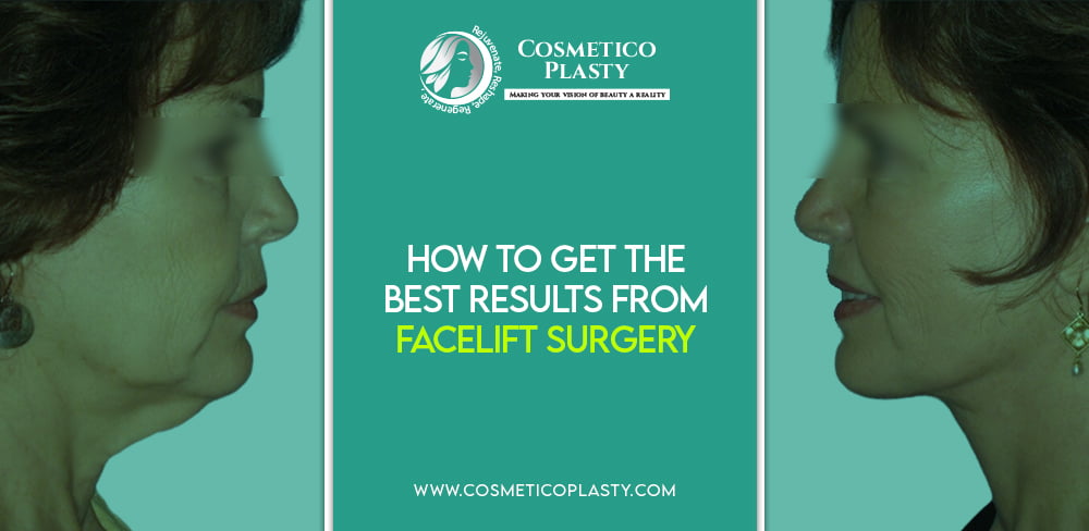 Best Results From Facelift