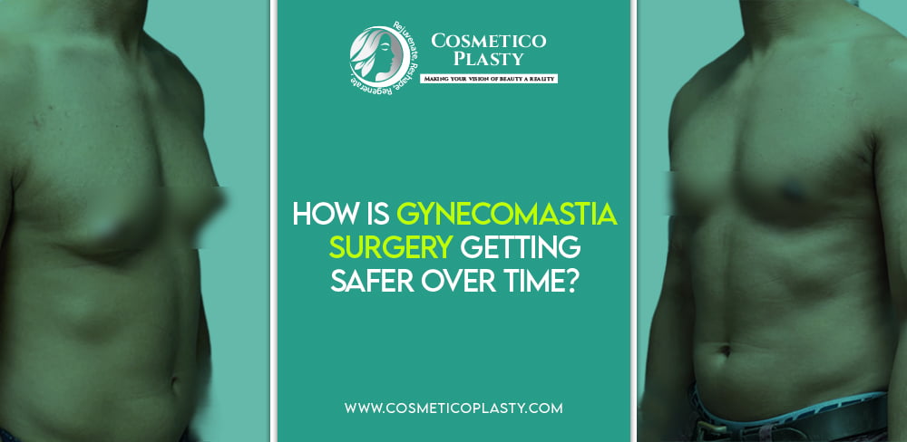 Gynecomastia Surgery Getting Safer Over Time
