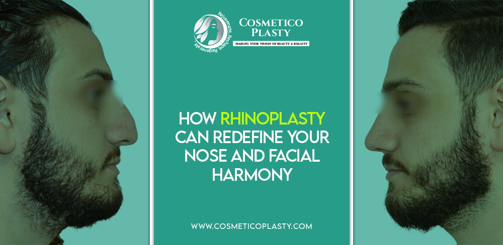 Rhinoplasty Can Redefine Your Nose and Facial Harmony