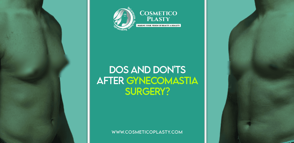 Dos and Don'ts After Gynecomastia Surgery