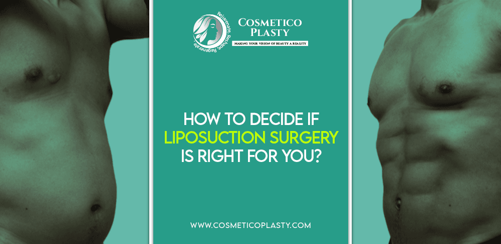 Deciding to have liposuction