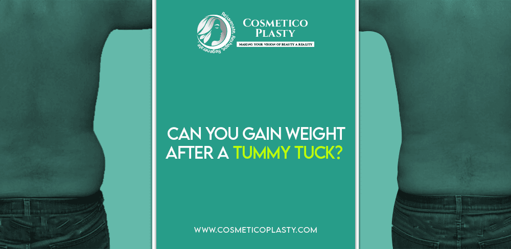 tummy tuck weight gain