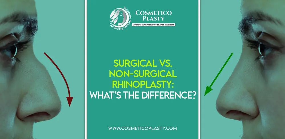 Surgical Rhinoplasty