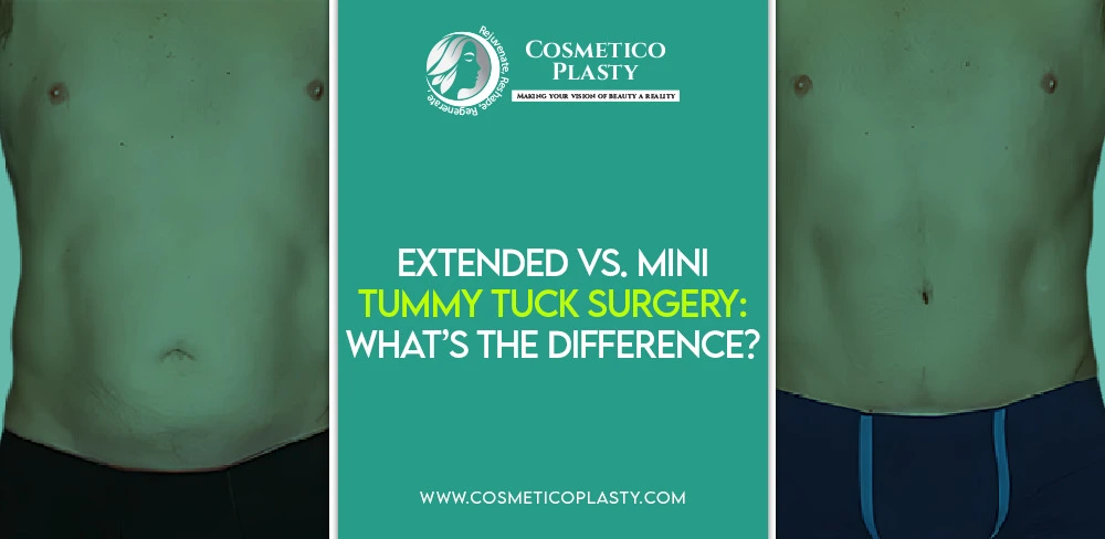 Extended vs. Mini Tummy Tuck Surgery