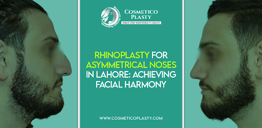 Rhinoplasty for Asymmetrical Noses
