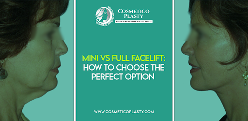 Mini Vs Full Facelift Surgery