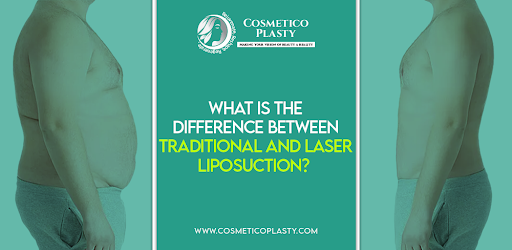 Traditional And Laser Liposuction