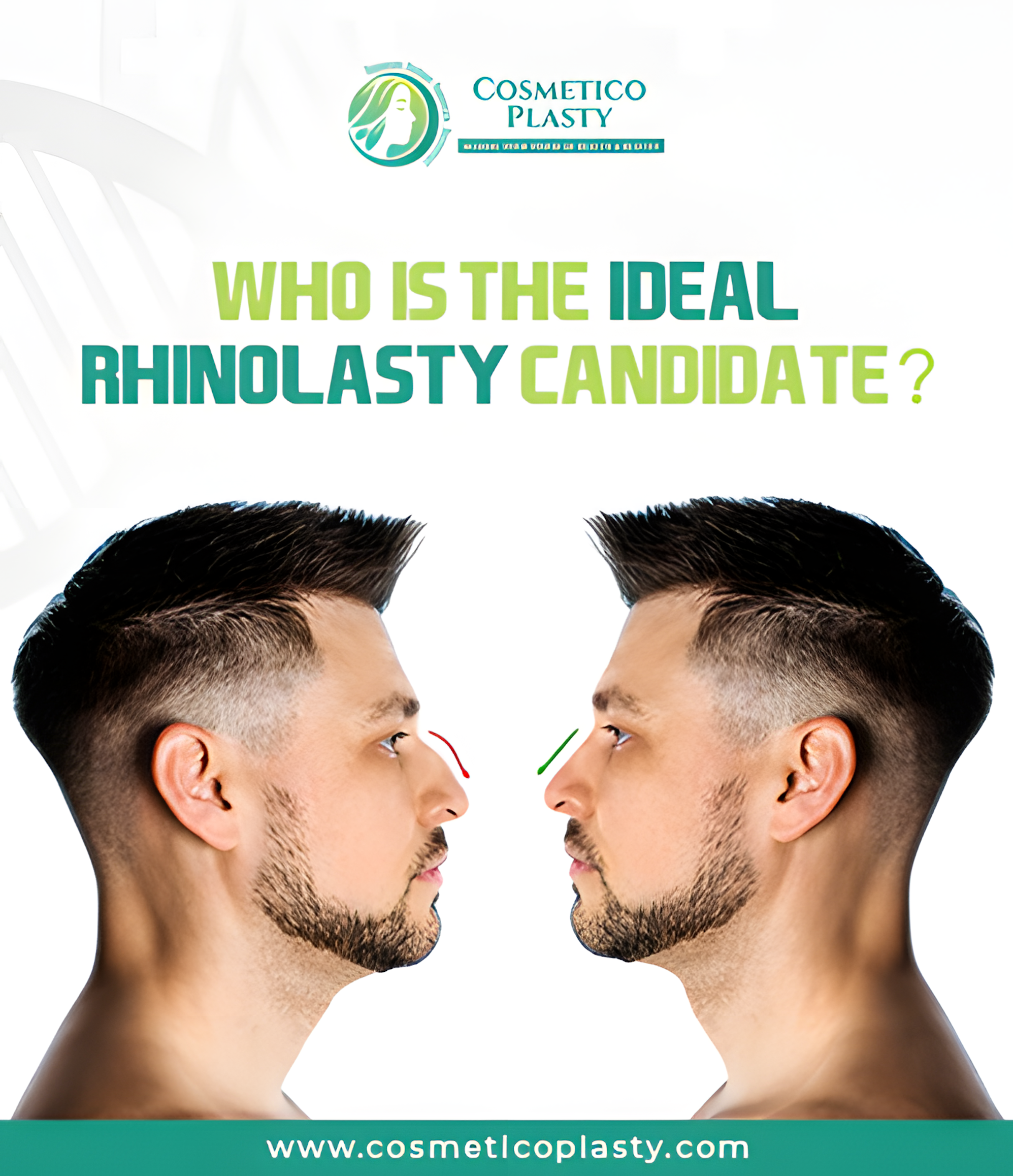 Who is the Ideal Rhinoplasty Candidate