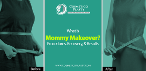 Mommy makeover