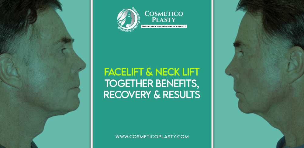 Facelift and Neck Lift Surgery