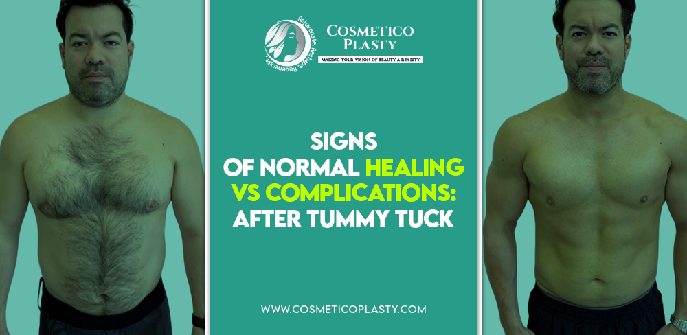Tummy Tuck surgery